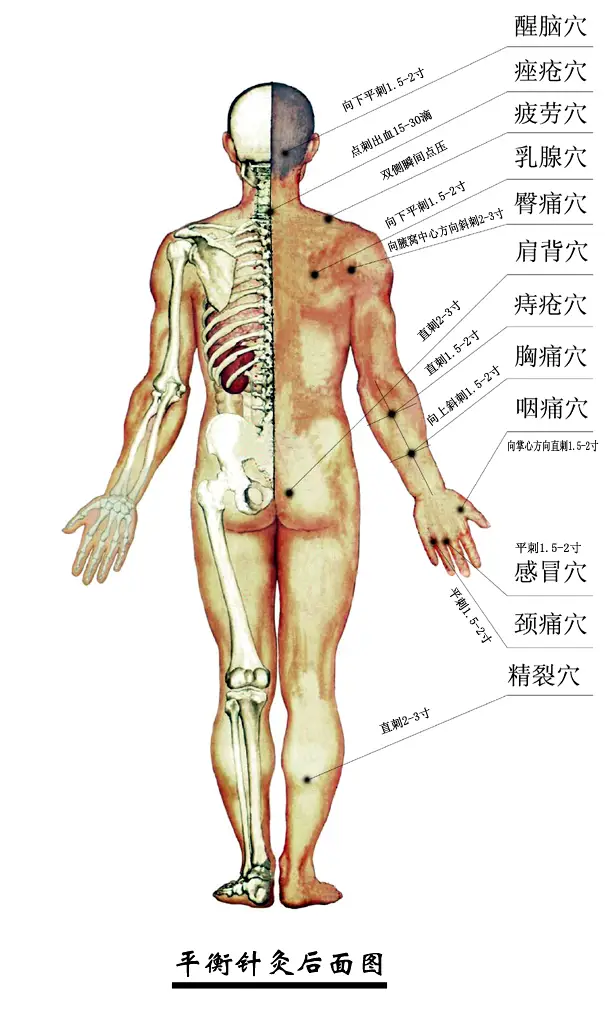 平衡针灸穴位定位图后