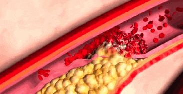 它才是猝死的“头号元凶”?很多人还不重视!警惕身体出现的几个异常....._健康160