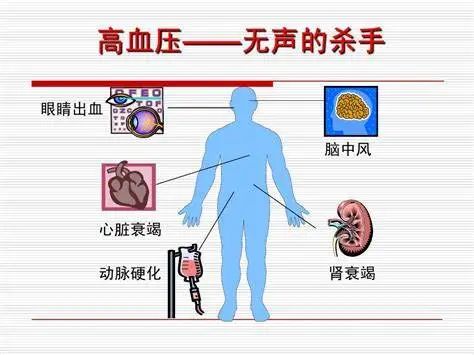 高血压是什么有几种