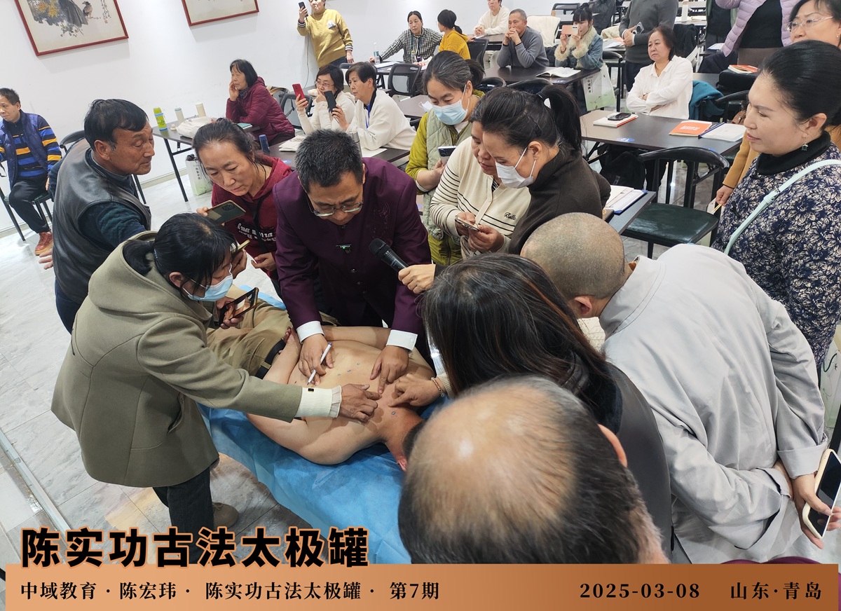 陈实功古法太极罐课程