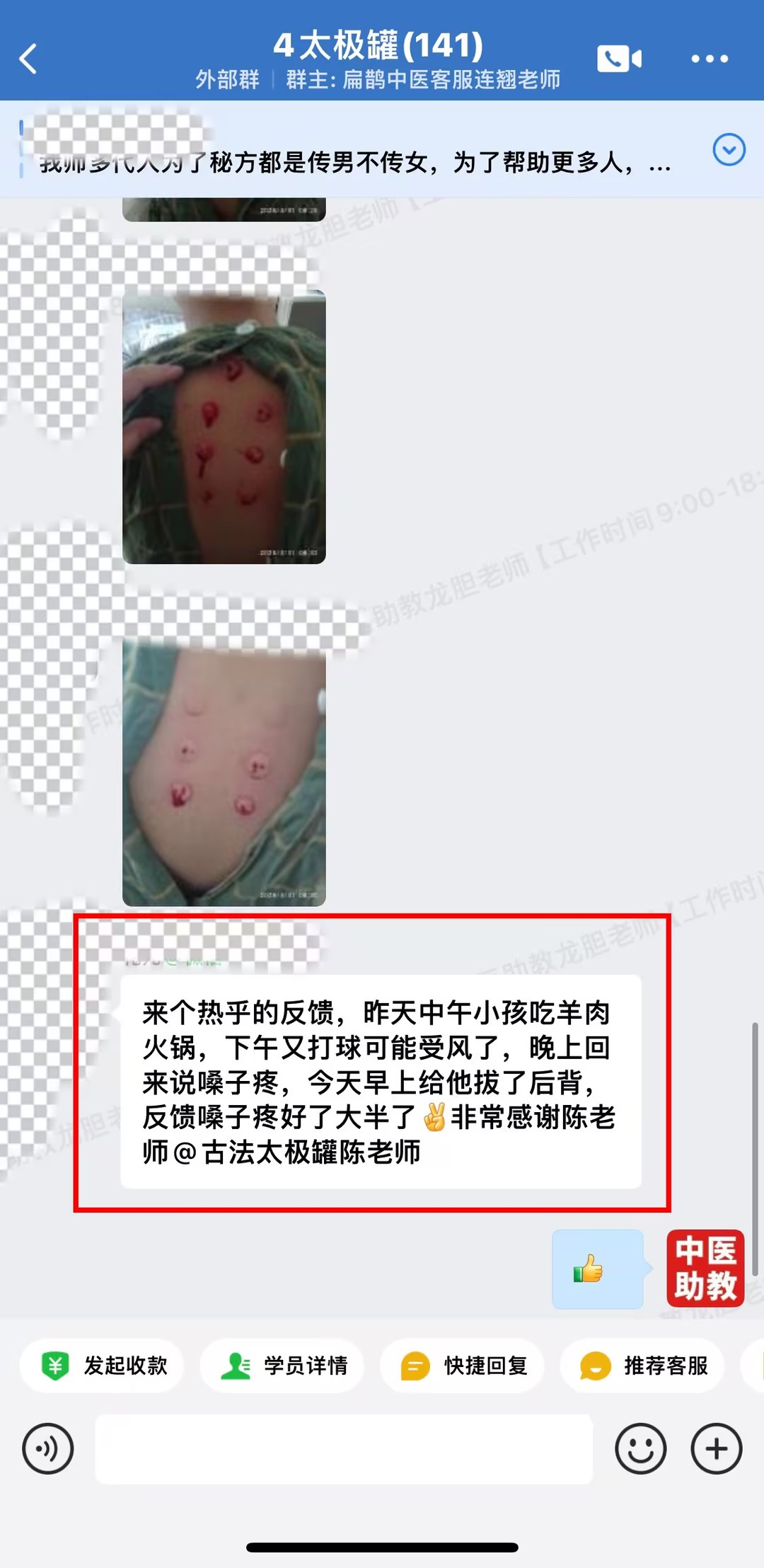 陈实功太极罐学员反馈：小孩吃羊肉又受风嗓子疼，太极罐拔了后背好了大半！