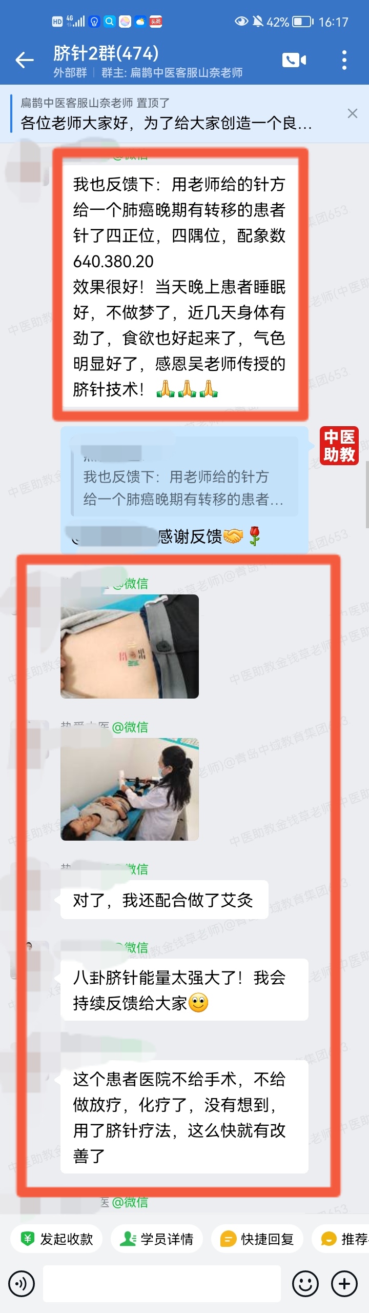 太极八卦脐针反馈：脐针调理失眠多梦，气色食欲等都有好转！