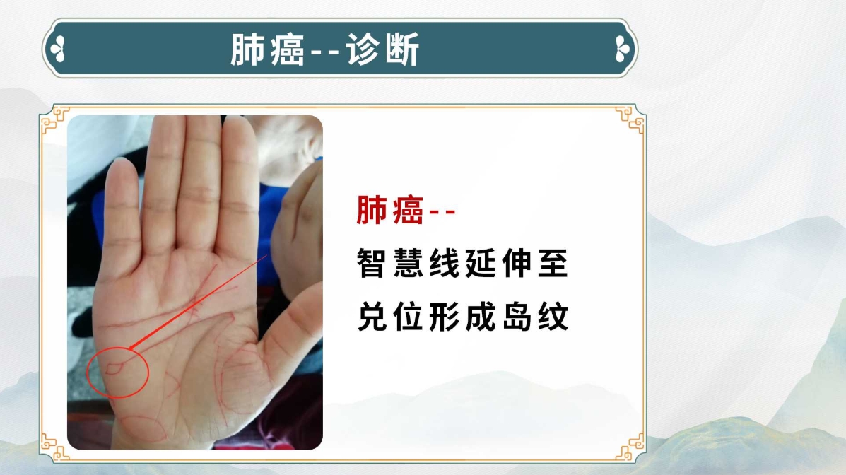 生命全息手诊线下进阶班：中医诊断实用技能，手诊技术系统教学！