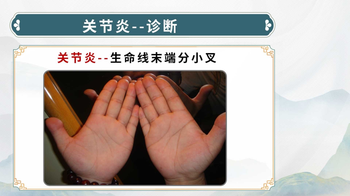 生命全息手诊线下进阶班：中医诊断实用技能，手诊技术系统教学！