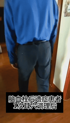 摸摸耳朵就让人重获健康！半路出家的她，凭什么让西医大夫心服口服？