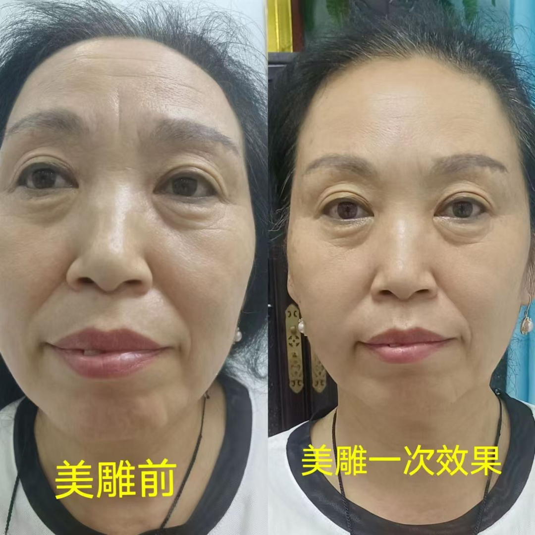 美国飞机上惊险抢回人命！中国非遗 「飞针」绝技震惊全球，20国跪求的神秘医术曝光！