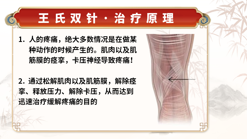 王氏实战双针术的调理理论是什么？