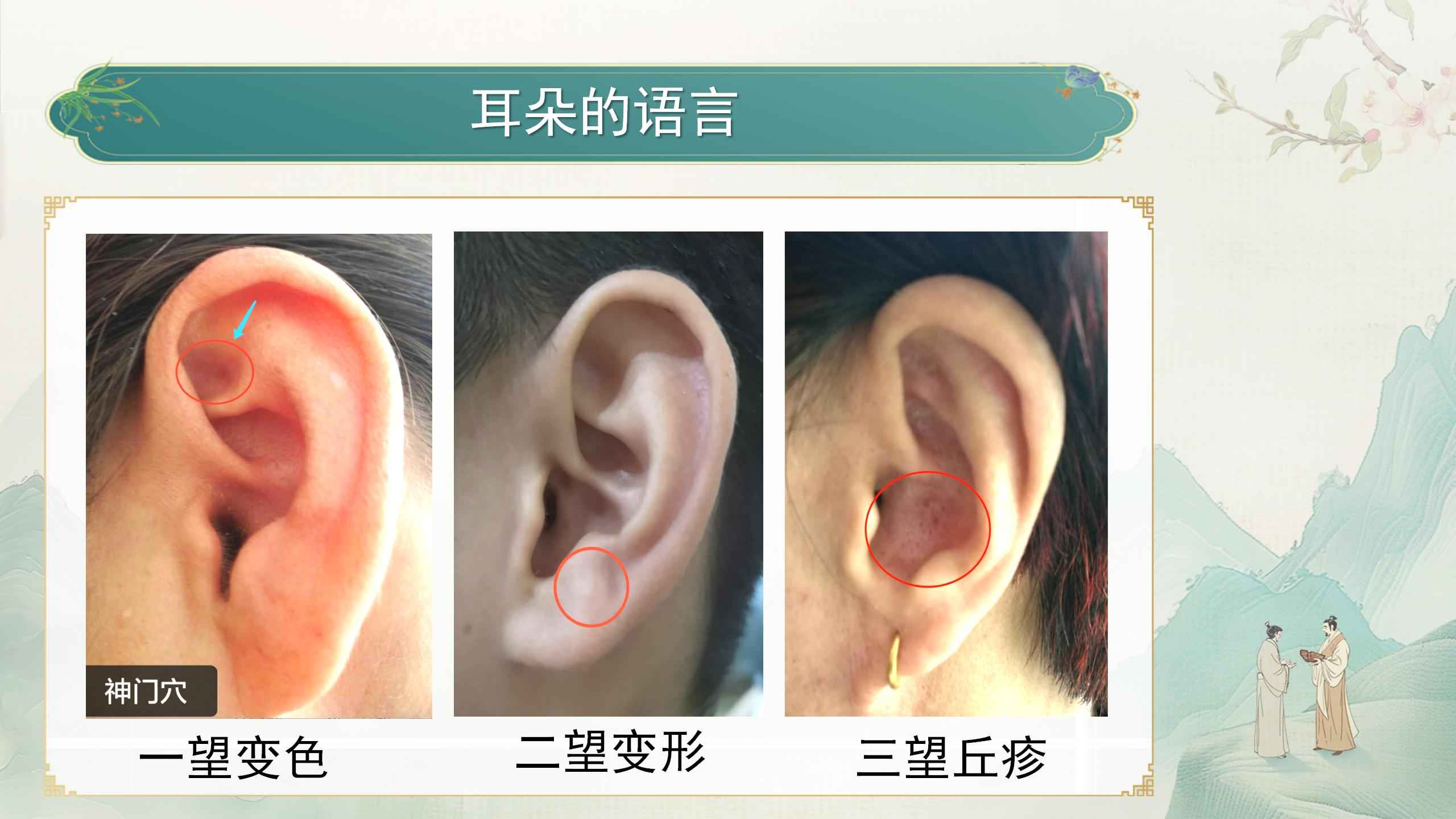250412elcy40.jpg