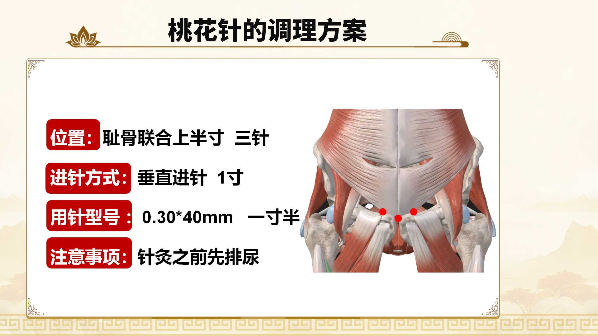 250308qhyy109.jpg